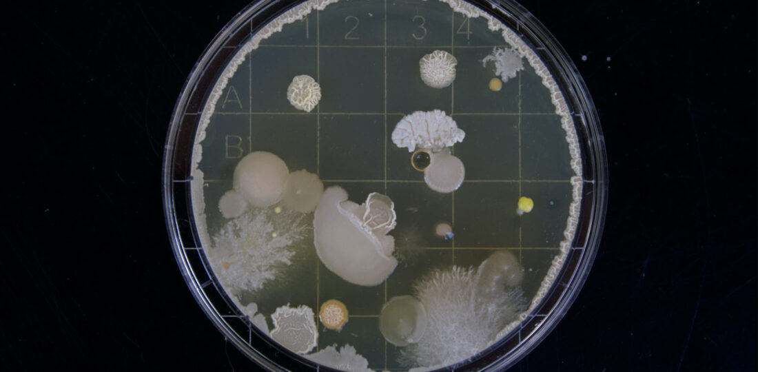 Researchers Discover Hidden Mechanism Driving Antibiotic Resistance In Bacteria