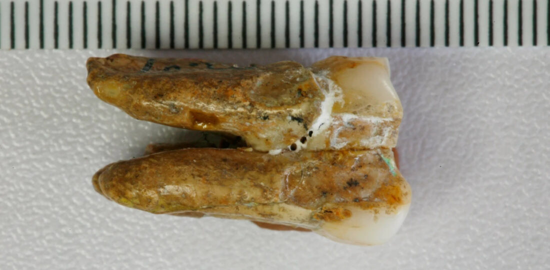 Ancient Teeth Hint At Canoodling Between Early Human Relatives