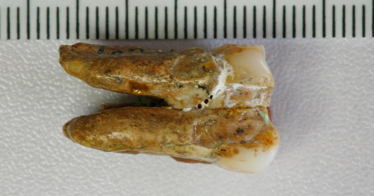 Ancient Teeth Hint At Canoodling Between Early Human Relatives
